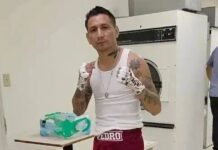 Pedro ‘Tony’ Rodriguez dies in hotel after bout